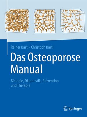 cover image of Das Osteoporose Manual